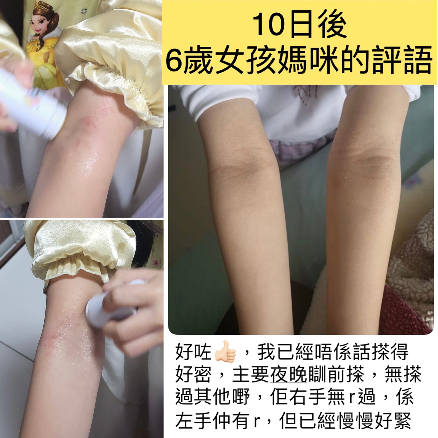 Eczema Balm